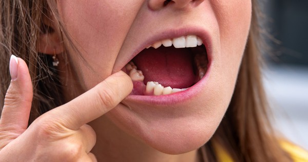 Nhật Bản thử nghiệm thuốc mọc lại răng cho người lớn, dự kiến 2030 sẽ bán ra
