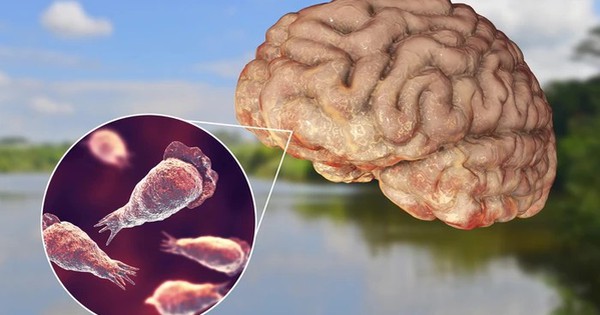 Phát hiện ‘amip ăn não’ trong nguồn nước sinh hoạt tại quốc gia có cộng đồng người Việt đông thứ 3 thế giới