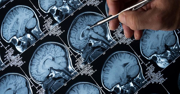 “Amip ăn não” lan rộng tại một bang ở Ấn Độ, tỷ lệ tử vong lên đến 97%