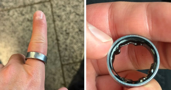 Người dùng hốt hoảng khi một sản phẩm của Samsung phồng pin, kẹt luôn trên ngón tay: "Vừa đau vừa sợ nổ"