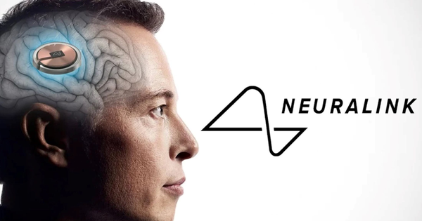Công ty của Elon Musk cấy chip vào não người chỉ trong 1,5 giây, độ chính xác cực cao giúp tránh các mạch máu nhỏ